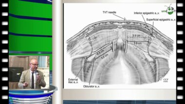 Пушкарь Д.Ю. - Свободная синтетическая петля: Свободная? Синтетическая? Петля?​