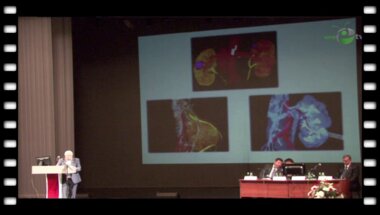 Аляев Ю.Г. - "Виртуальные операции при заболеваниях почки, их значимость для реальной хирургии"