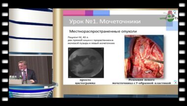 Царьков П.В. - "Урология для колопроктолога"