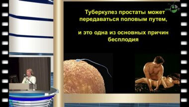 Кульчавеня Е.В. - "Оптимизация подхода к химиотерапии больных туберкулезом простаты"