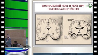 Тишова Ю.А. - Болезнь Альцгеймера - диабет 3 типа?