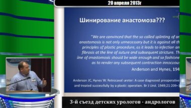 Каганцов И.М. "Опыт выполнения лапароскопической пиелопластики у детей до года"