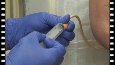 Методика выполнения антеградной пиелоуретероцистографии