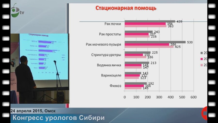 Капсаргин Ф.П. - "Диагностика и лечение папиллярных опухолей верхних мочевыводящих путей"