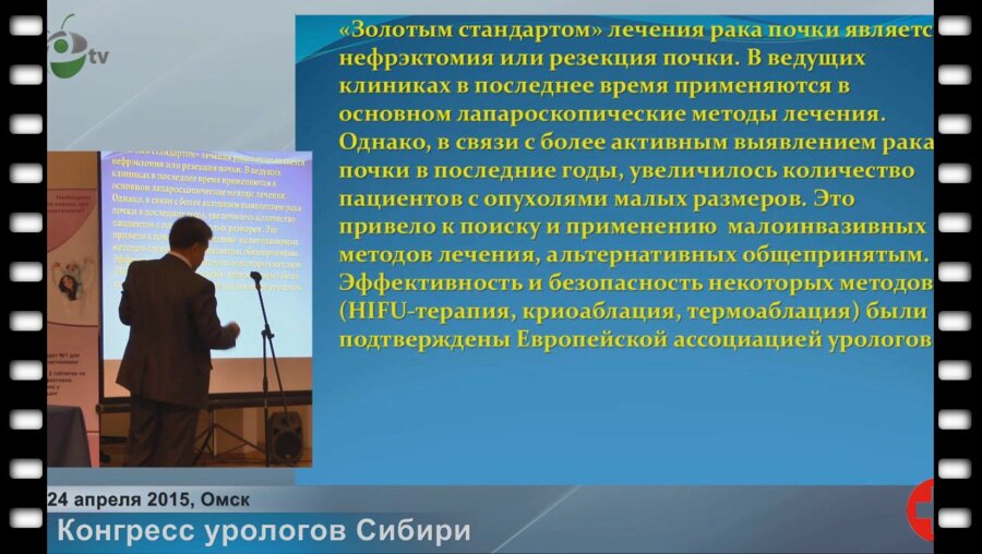 Феофилов И.В. - "Современная хирургия рака почки"