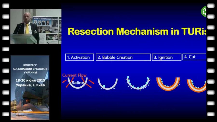 Удо Йонас - Обзор современных методов хирургического лечения в урологии