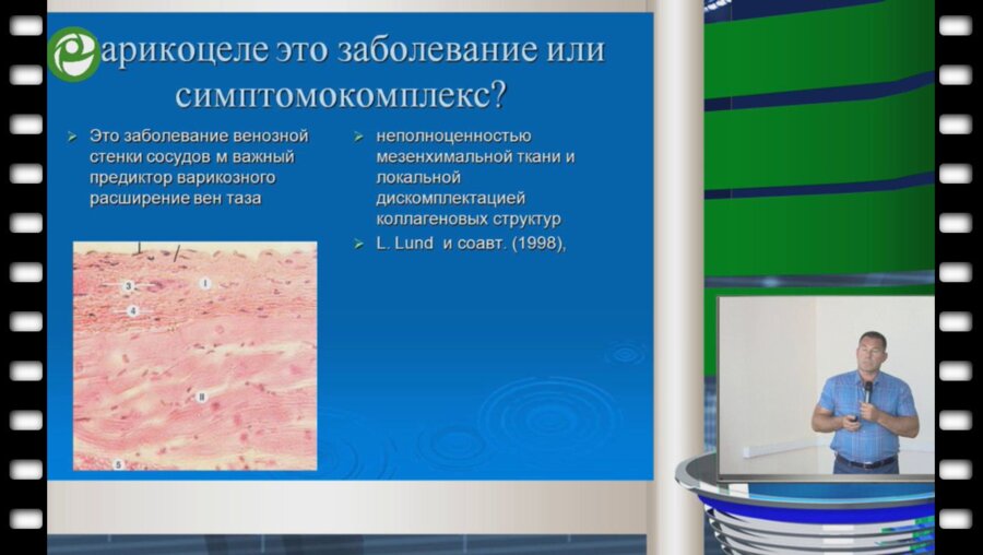 Жуков О.Б. - Современные диагностические алгоритмы варикоцеле