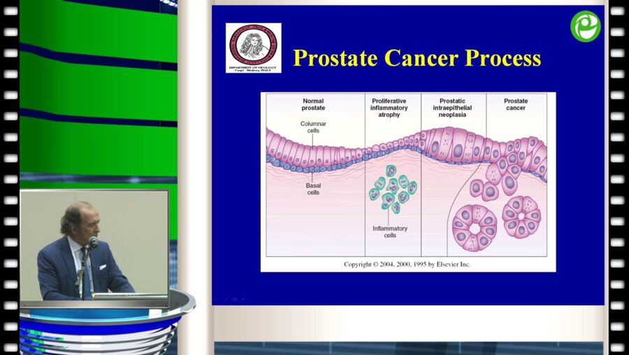 Maurizio Brausi - Эпигаллокатехина галлат. Простатопротекторы нового поколения
