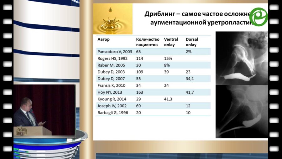 Котов С.В. - Недержание мочи и его лечение