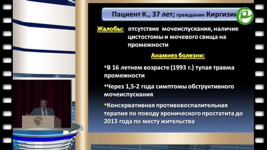 Митусов В.В. - Металлический стент при стриктуре бульбозной уретры – исход в тупик?