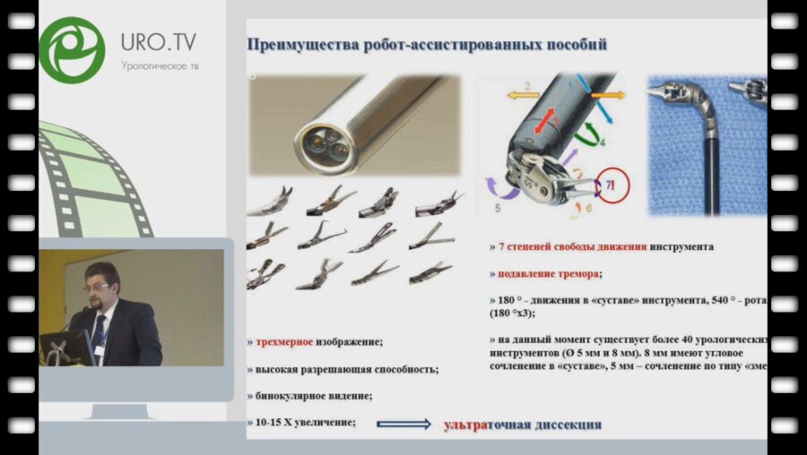 Е.А. Безруков - Как мы осваиваем роботическую радикальную простатэктомию.