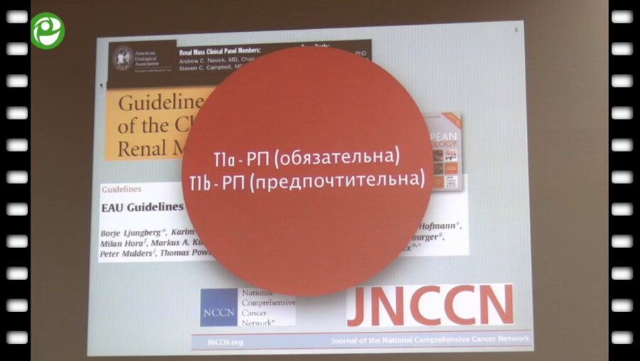 Ракул С.А. - Современные тенденции в лечении рака почки в условиях многопрофильного стационара