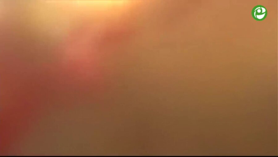 Лапароскопическая резекция левой почки