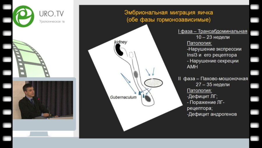 Морозов Д.А. - Контроль репродуктивной системы мальчиков с крипторхизмом