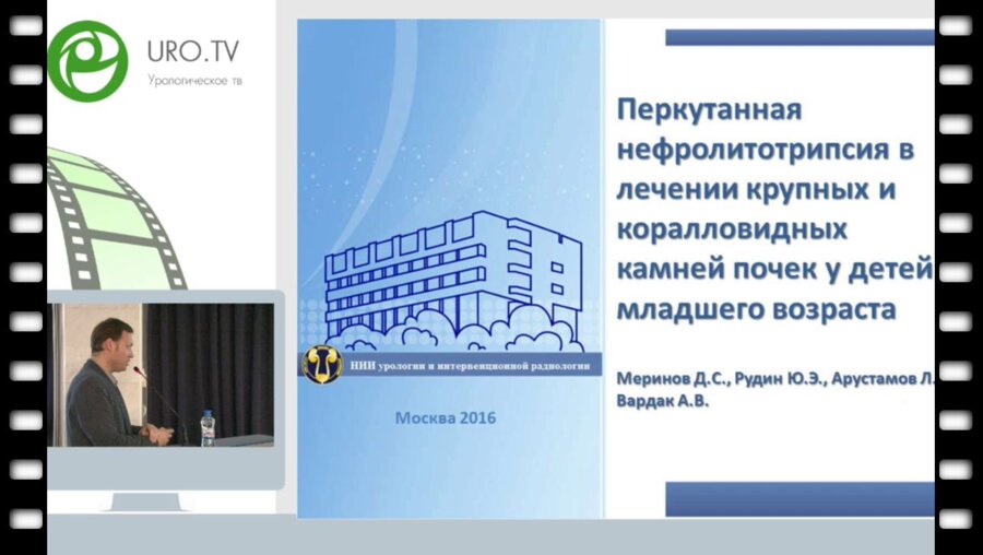 Меринов Д.С. - Перкутанная нефролитотрипсия в лечении крупных и коралловидных камней почек у детей младшего возраста