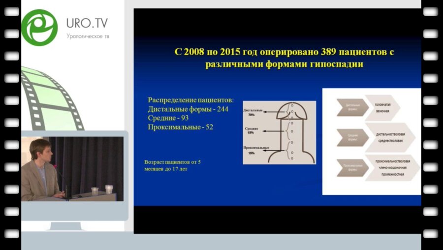 Демин Н.В. - Результаты лечения 389 пациентов с различными формами гипоспадии