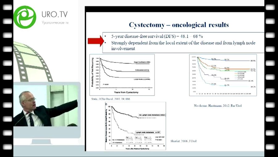 M. Babjuk - Радикальная цистектомия при локализованном раке мочевого пузыря