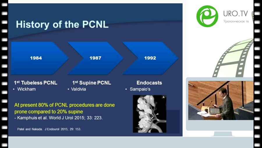 Brian Duty - Percutaneous nephrolithotomy positioning