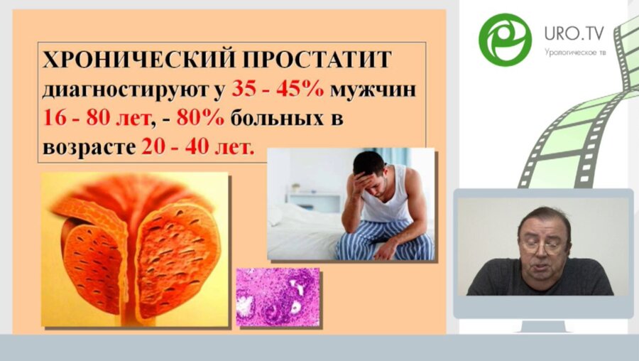 Час с ведущим урологом: Современный пациент с хроническим простатитом. Что изменилось за 20 лет?