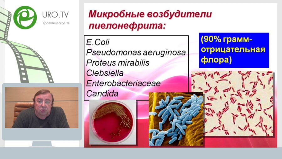 Час с ведущим урологом: Острый пиелонефрит – что должен знать уролог в 2017 году?