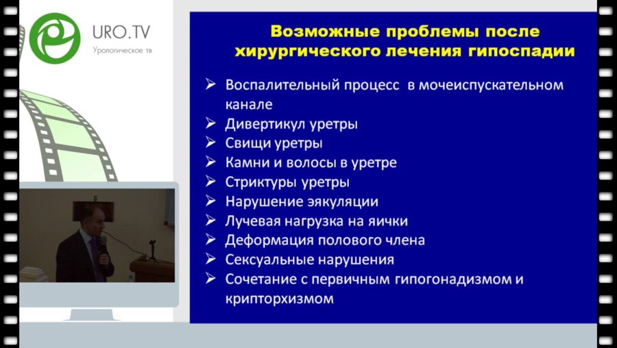 Гамидов С.И. - Роль двухэтапной буккальной уретропластики у пациентов после неудачных операций по поводу гипоспадии