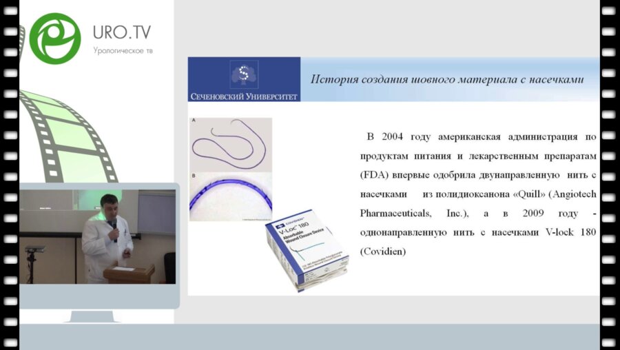 Сирота Е.С. - Применение шовного материала с насечками в урологии