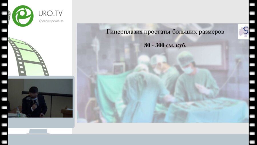 Хамраев О.Х. - Гиперплазия простаты больших размеров. HOLEP vs Позадилонная аденомэктомия