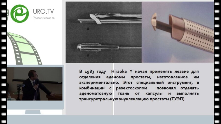 Цариченко Д.Г. - Монополярная энуклеация