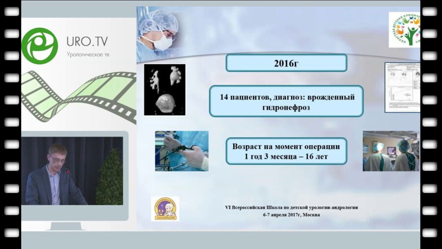 Баранов Ю.В. - Опыт лапароскопической пиелопластики у детей