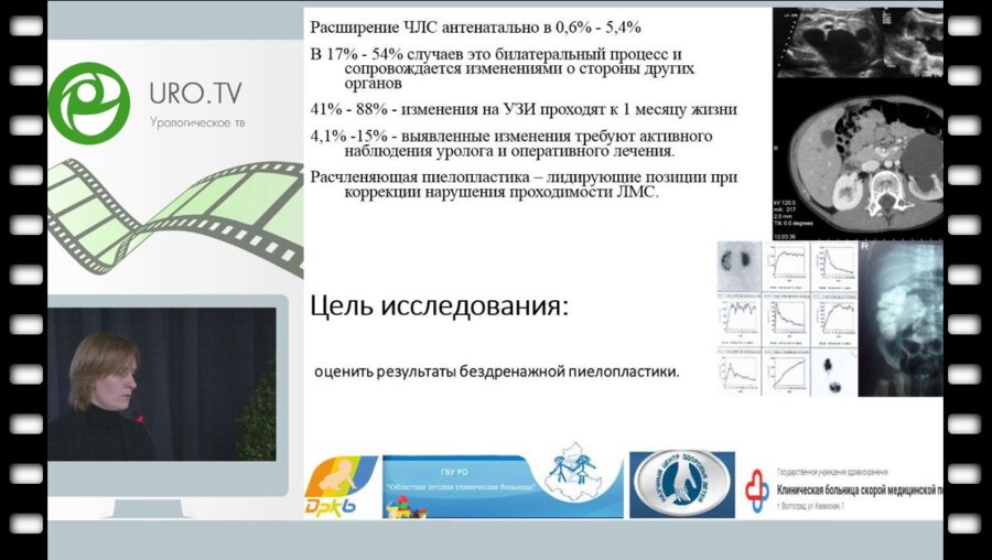 Борисова С.А. - Результативность бездренажного ведения больных с гидронефрозом по данным многоцентрового исследования