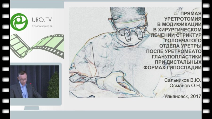 Сальников В.Ю. - Прямая уретротомия в модификации в хирургическом лечении стриктур го­ловчатого отдела уретры после уретромеатогланулопластики