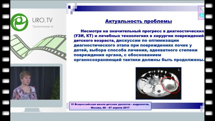 Цап Н.А. - Травма в детской урологии-андрологии