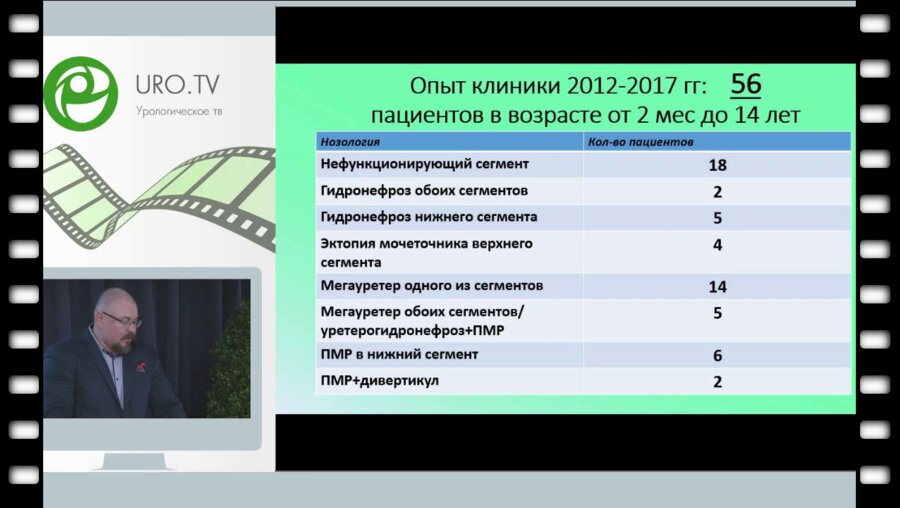 Эндовидеохирургические возможности реконструкции верхних мочевых пу­тей при удвоении