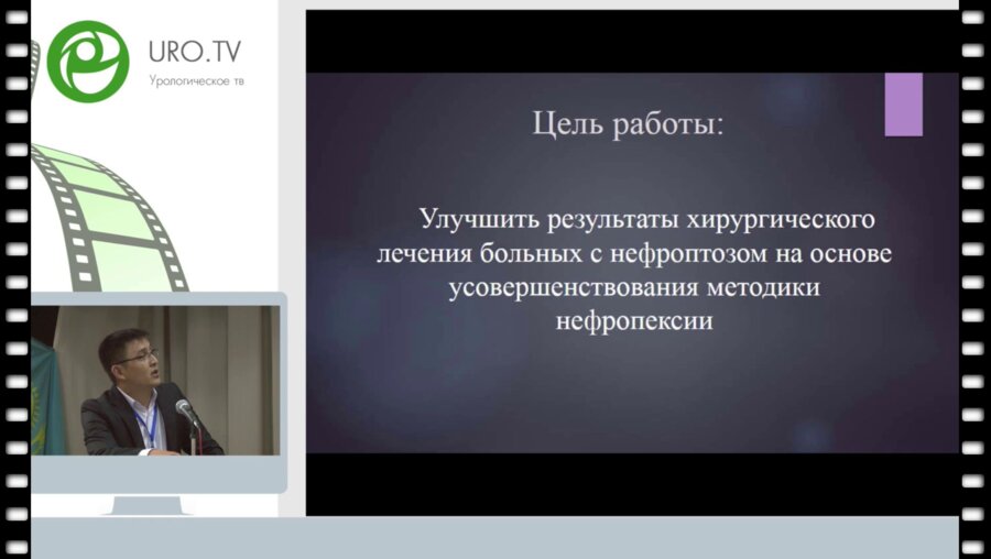 Мамбетов Ж.С. - Оптимизация хирургического лечения нефроптоза