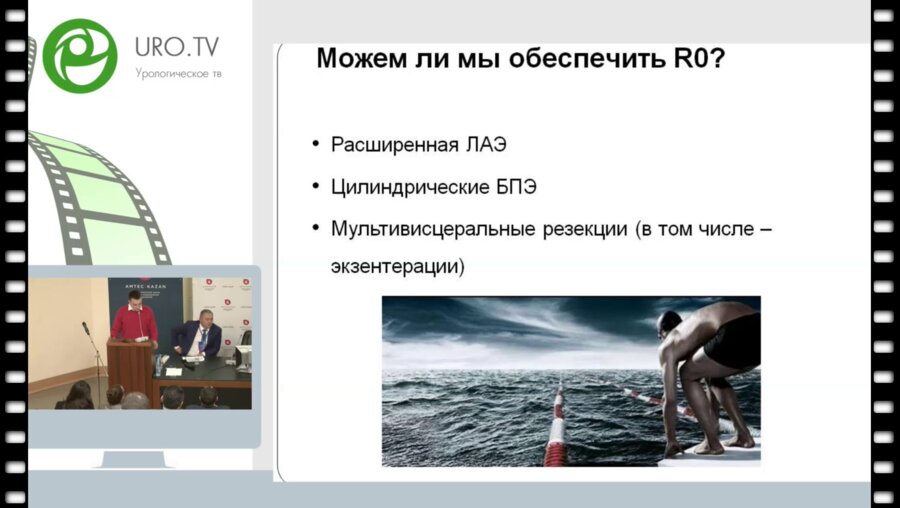 Мошуров М.И. - Опыт 100 экзентераций малого таза по поводу первичного и рецидивного рака прямой кишки