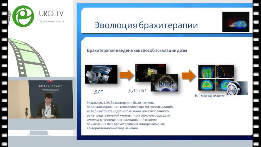 Цыбульский А.Д. - Высокомощностная брахитерапия источником Ir-192 в лечении рака предстательной железы