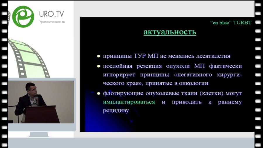 Байков Н.А. - Современные методы диагностики и лечения мышечно-неинвазивного рака мочевого пузыря