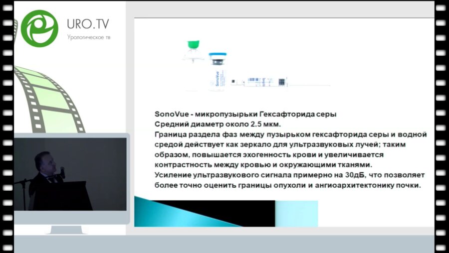 Гурцкой Р.А. - До - и интраоперационная ультразвуковая диагностика опухолей почки с введением контрастного вещества