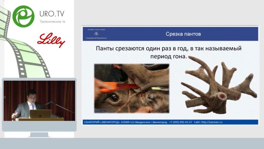 Коваленко А.А. - Пантовые ванны санатория Звенигород  уникальные возможности реабилитации