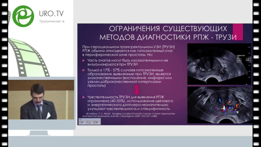 Кадрев А.В. - Возможности ультразвуковой эластографии сдвиговой волной в диагностике РПЖ