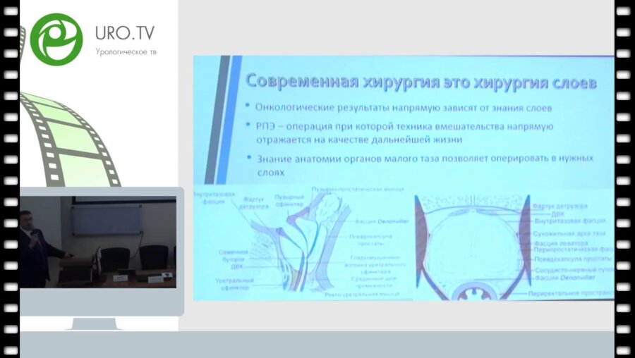 Безруков Е.А. - «Milestones» лапароскопической и робот-ассистированной радикальной простатэктомии