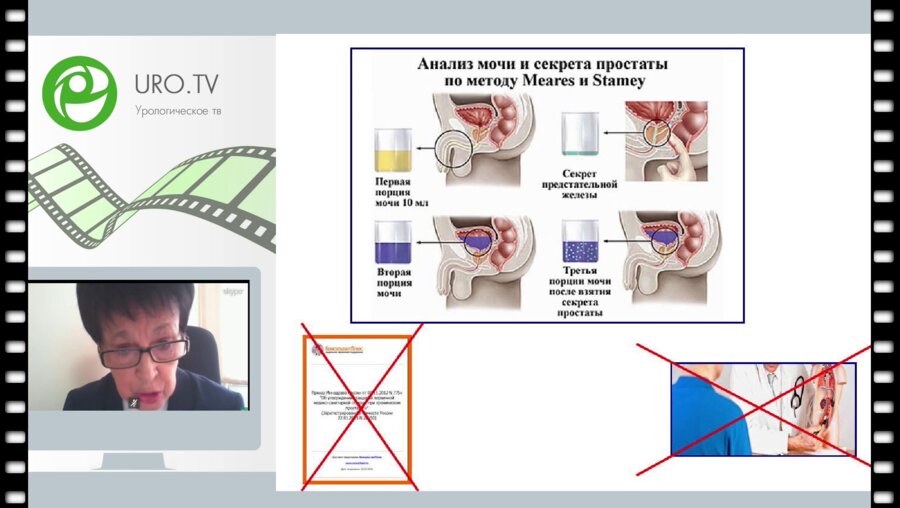 Кузнецова Н.Н. - Хронический простатит и материал для его исследований