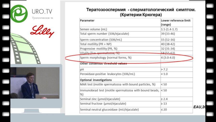 Охоботов Д.А. - Современные методы лечения тератозооспермии