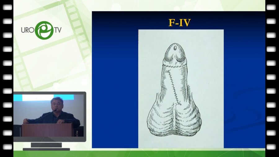 Файзулин А.К. - Современные аспекты пластической генитальной хирургии у детей