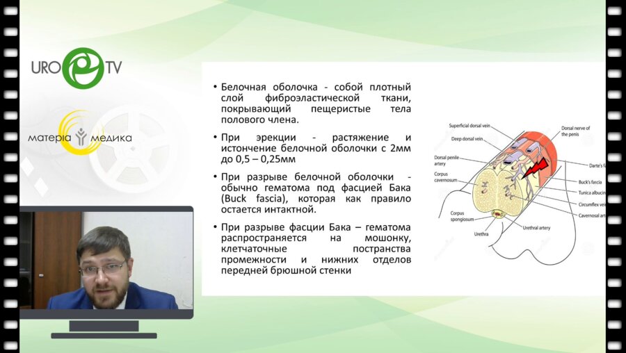 Беломытцев С.В. - Перелом полового члена