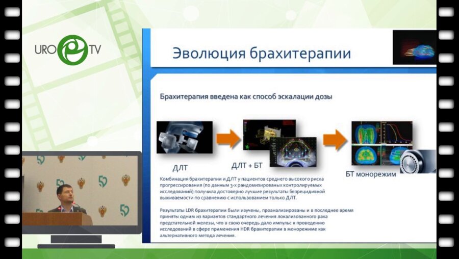 Цыбульский А.Д. - Возможности HDR брахитерапии в лечении рака простаты