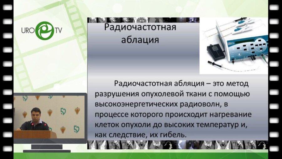 Кравцов И.Б. - Малоинвазивные методы лечения рака почки