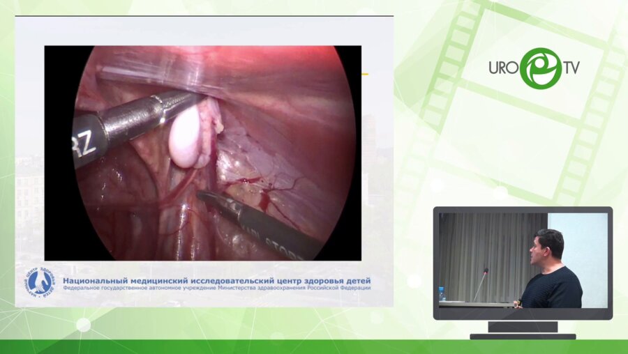 Карпачев С.А. - Наш опыт лапароскопических операций в практике детского уролога