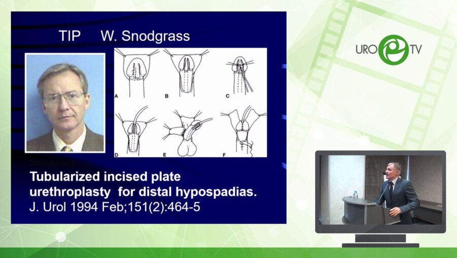 Рудин Ю.Э. - Аугментация головки полового члена у детей с гипоспадией. Показания, техника, результаты лечения