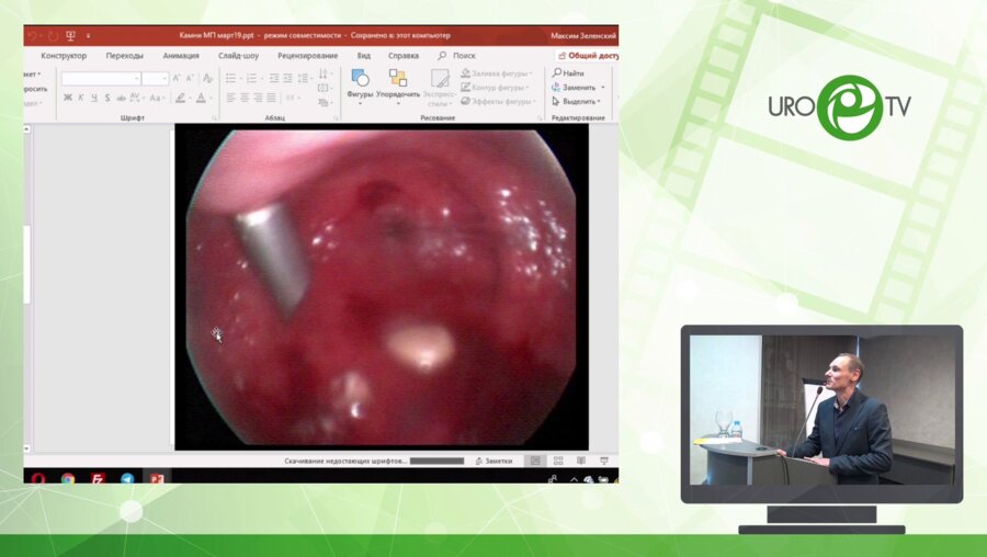 Сарычев С.А. - Эволюция подхода к лечению конкрементов мочевого пузыря у детей